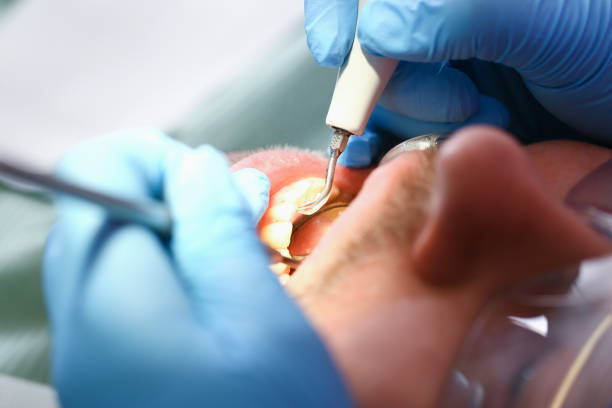 Best Mobile Emergency Dentist in Galva, IL