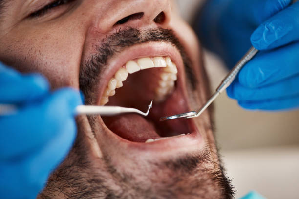 Best Broken or Cracked Tooth Emergency Dentist in Galva, IL